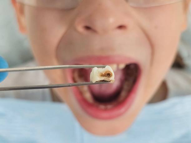 Best Emergency Denture Repair in Montello, WI